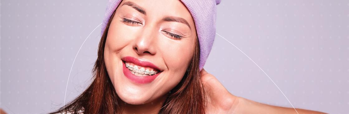 Alimentos que debes evitar si usas brackets